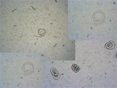 Trichinella spiralis